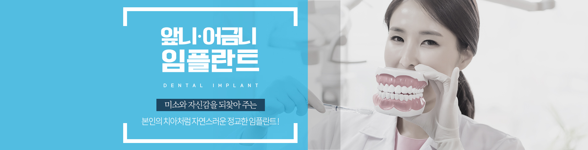 앞니/어금니 임플란트 안내 - 다산리더스치과의원