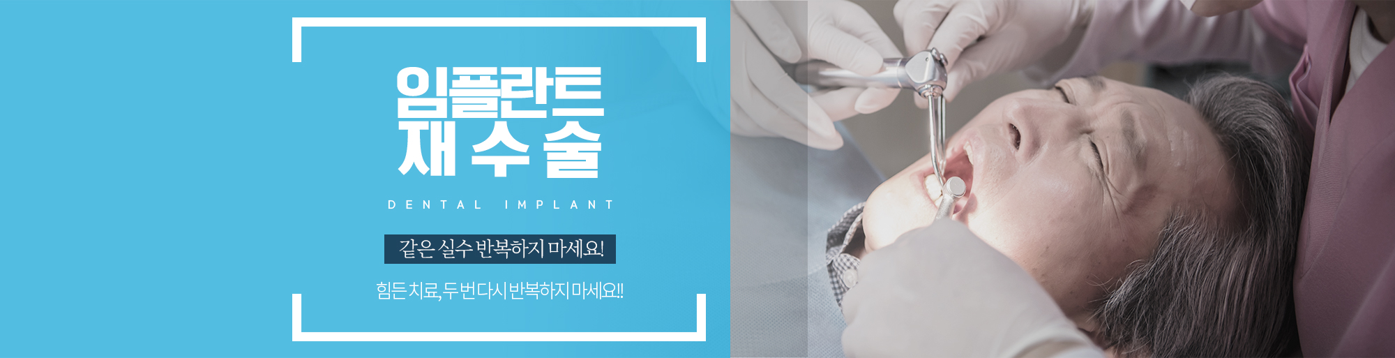 임플란트 재수술 안내 - 다산리더스치과의원