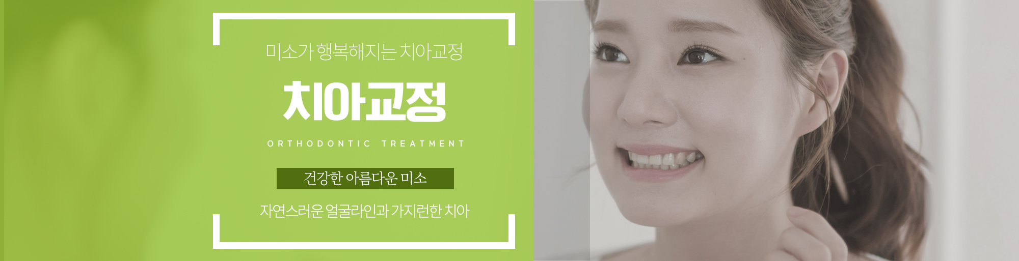 치아교정? 안내 - 다산리더스치과의원
