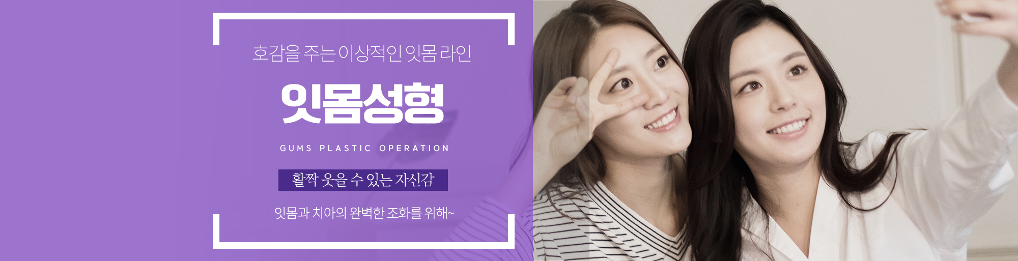 잇몸성형 안내 - 다산리더스치과의원