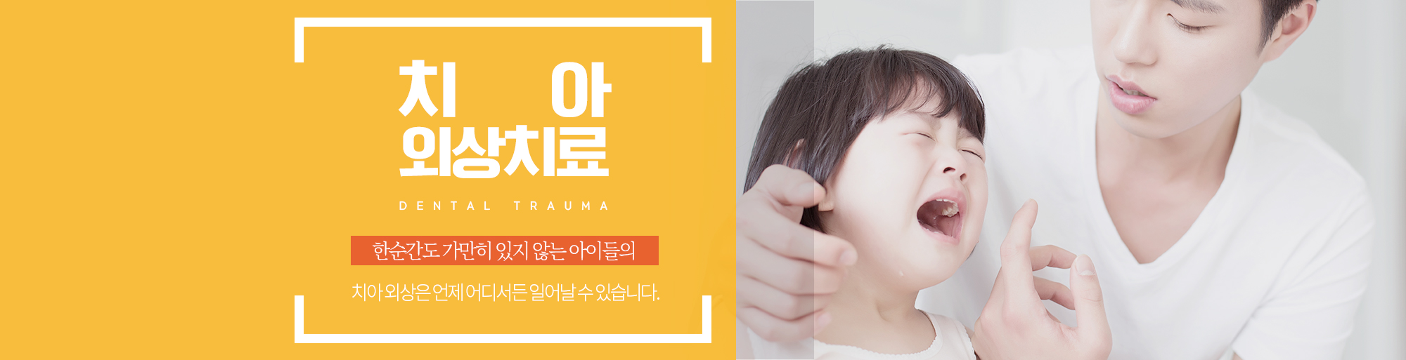 치아외상치료 안내 - 다산리더스치과의원