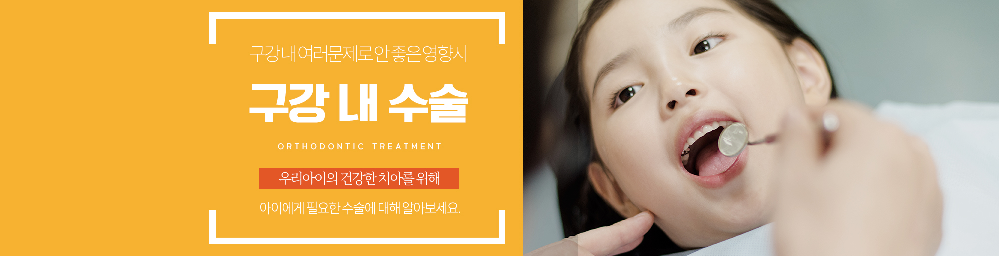 구강내수술 안내 - 다산리더스치과의원